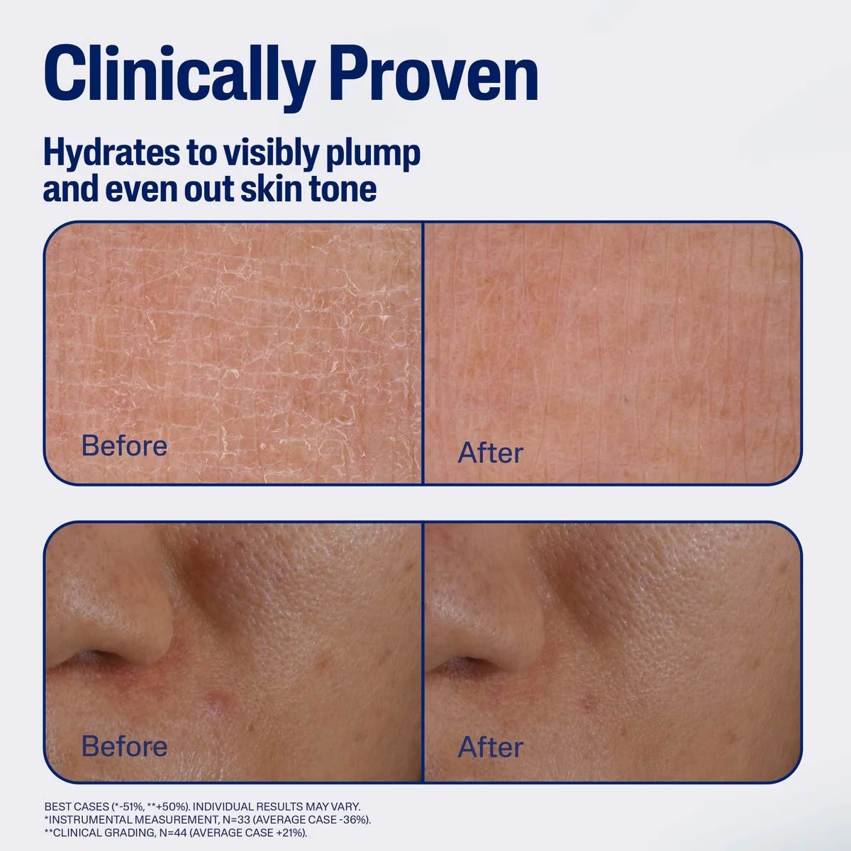 Cetaphil Repair & Renew Night Face Serum for Stressed Sensitive Skin with Gallic Acid & Vitamin E - Travel Size - 1 fl oz