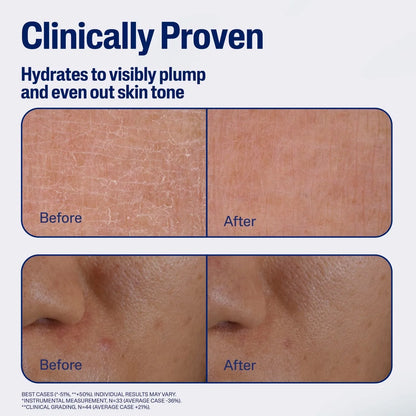 Cetaphil Repair & Renew Night Face Serum for Stressed Sensitive Skin with Gallic Acid & Vitamin E - Travel Size - 1 fl oz