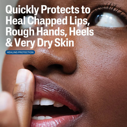 Cetaphil Multi-Purpose Healing Ointment for Dry, Cracked Skin and Chapped Lips with Shea Butter and Vitamin E - 12oz
